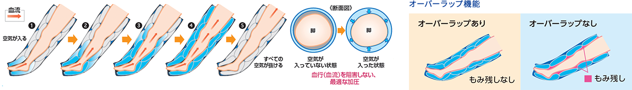 精管切除は勃起機能に影響を及ぼしますか？